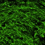 Immunofluorescent (IF) image of human lung fibroblasts with TGF-β treatment labeled with DSHB anti-FN1 [HFN 7.1]. PMID: 39038657, Fig. 3B